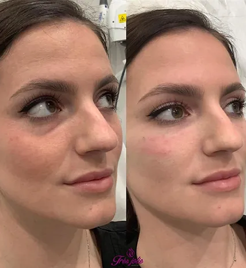 UnderEyes