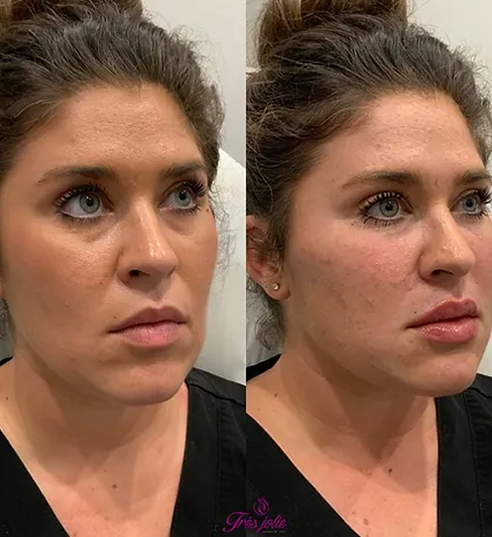 UnderEyes