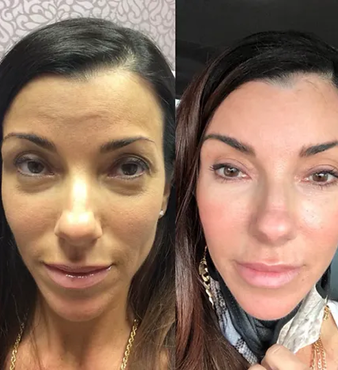 UnderEyes