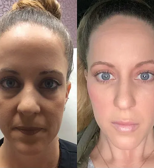 UnderEyes